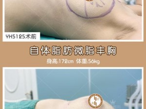 丰胸哺乳标清_标清【丰胸哺乳标清_标清有什么用？】