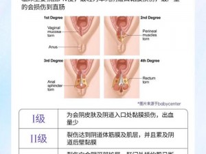 俄罗斯bobe撕裂,俄罗斯 bobe 撕裂：原因、影响与应对策略